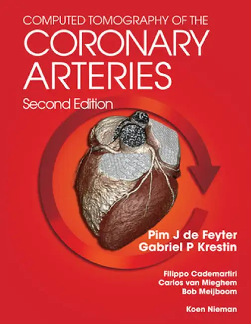 Computed Tomography of the Coronary Arteries by Pim J. de Feyter
