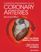 Computed Tomography of the Coronary Arteries by Pim J. de Feyter
