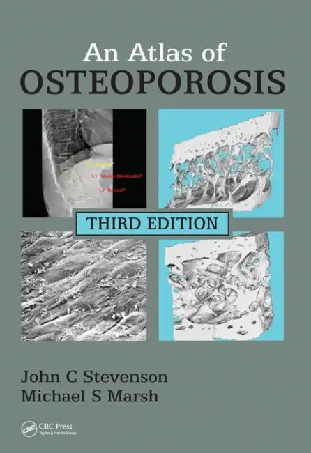 An Atlas of Osteoporosis by Stevenson John C.