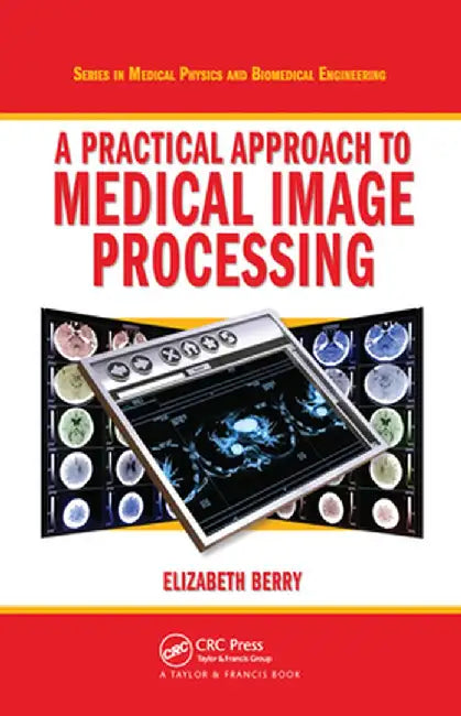 A Practical Approach to Medical Image Processing by Elizabeth Berry