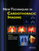 New Techniques in Cardiothoracic Imaging by Phillip M. Boiselle