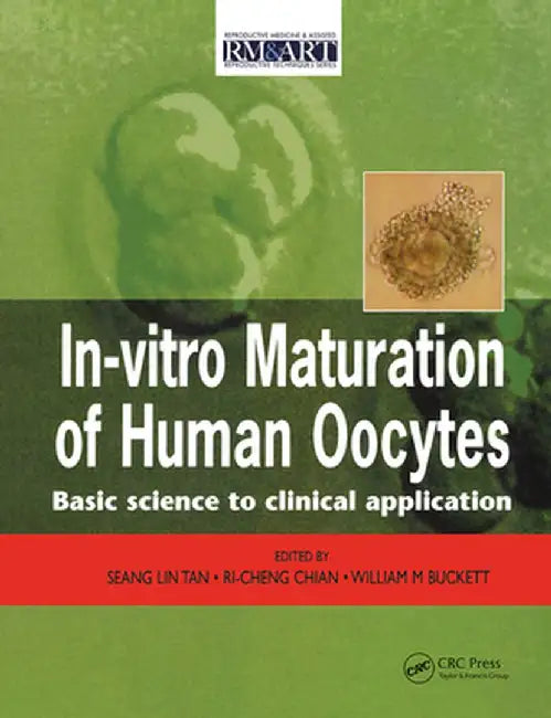 In Vitro Maturation of Human Oocytes by Seang Lin Tan