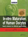 In Vitro Maturation of Human Oocytes by Seang Lin Tan