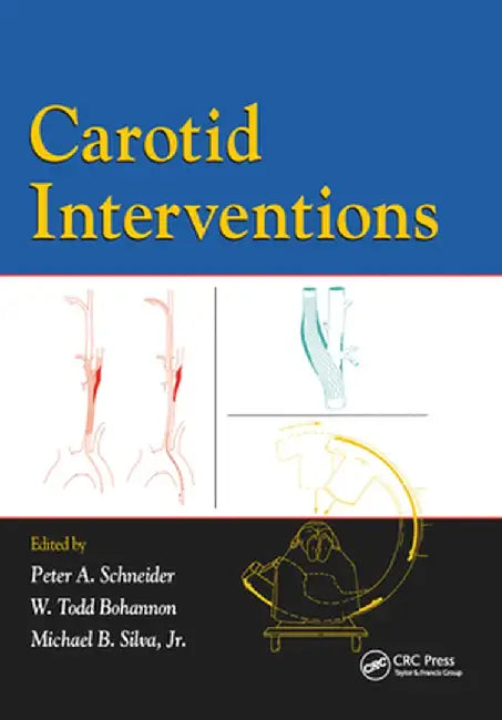 Carotid Interventions by Peter Schneider