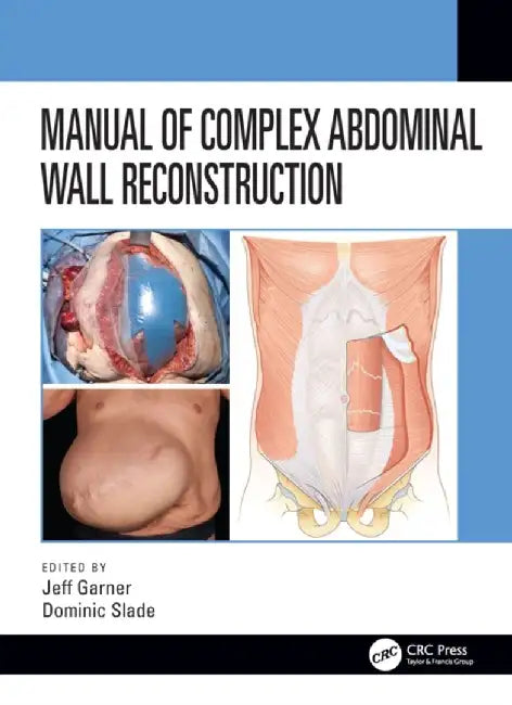 Manual of Complex Abdominal Wall Reconstruction by Jeff Garner
