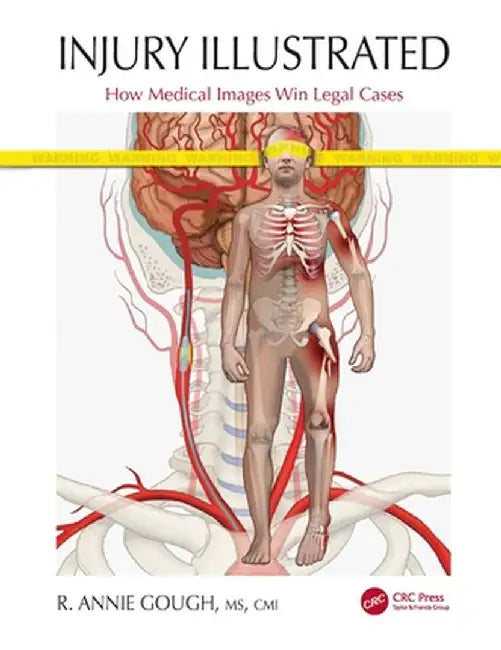 Injury Illustrated: How Medical Images Win Legal Cases by R. Annie Gough