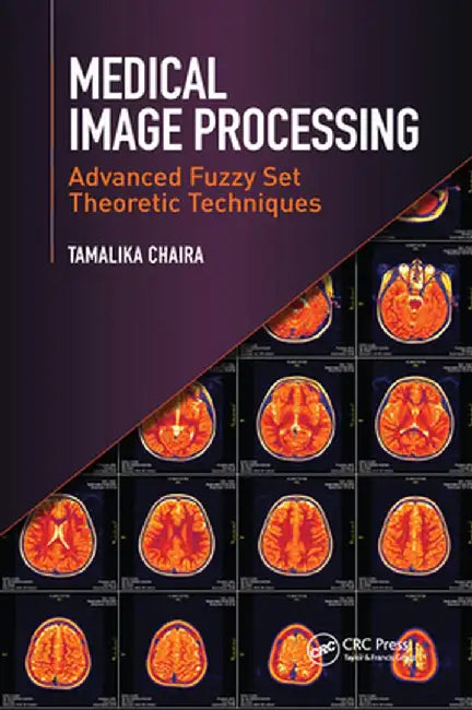 Medical Image Processing: Advanced Fuzzy Set Theoretic Techniques by Tamalika Chaira