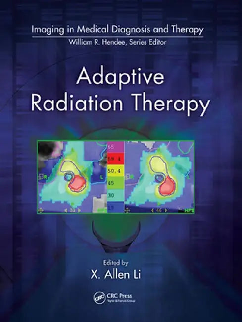 Adaptive Radiation Therapy by X. Allen Li