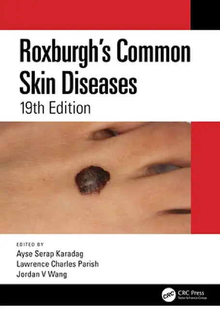 Roxburgh's Common Skin Diseases by Ayse Serap Karadag