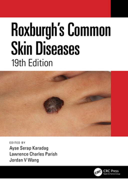 Roxburgh's Common Skin Diseases by Ayse Serap Karadag