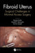 Fibroid Uterus: Surgical Challenges in Minimal Access Surgery by Rooma Sinha
