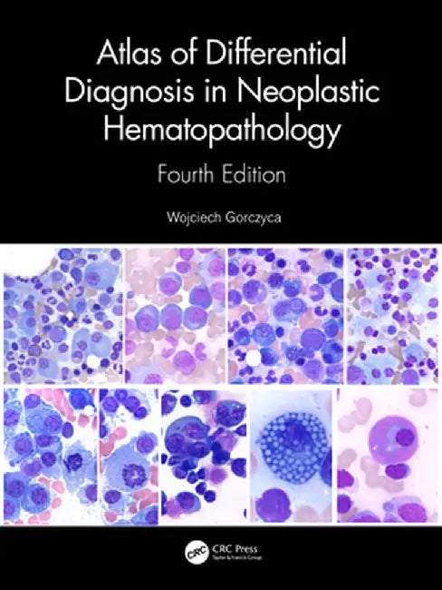 Atlas of Differential Diagnosis in Neoplastic Hematopathology by GORCZYCA, Robert