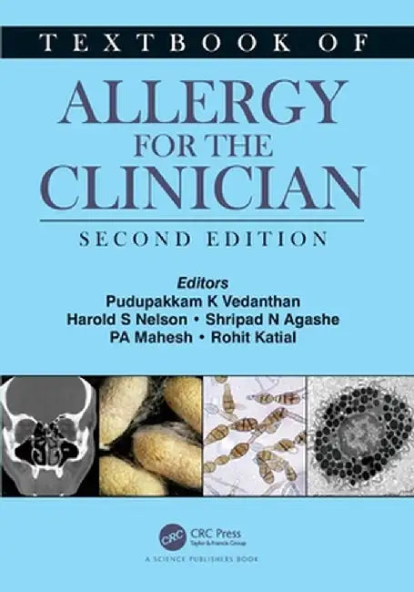 Textbook of Allergy for the Clinician by Pudupakkam K. Vedanthan