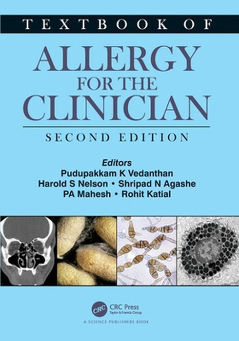 Textbook of Allergy for the Clinician by Pudupakkam K. Vedanthan