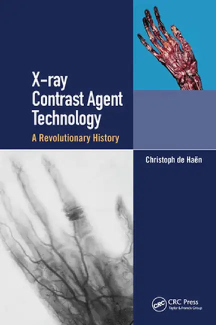 X-Ray Contrast Agent Technology: A Revolutionary History by Christoph de Haen