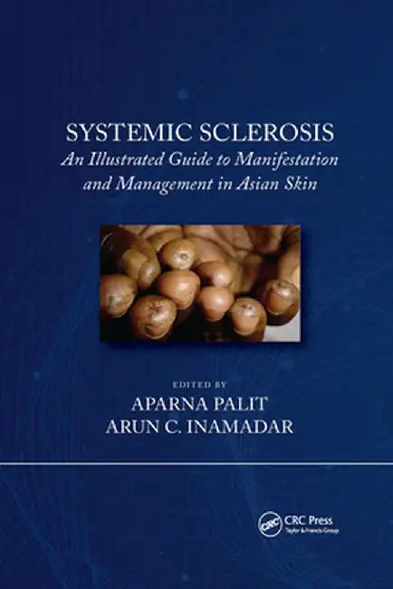 Systemic Sclerosis: An Illustrated Guide to Manifestation and Management in Asian Skin by Arun C Inamadar