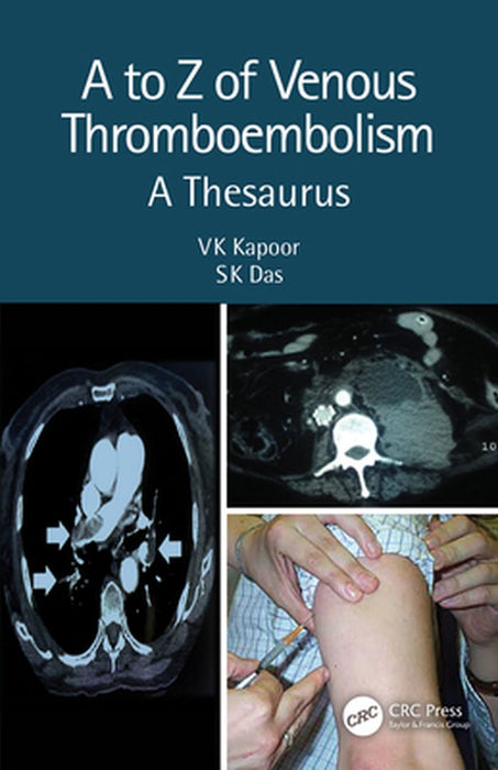 A to Z of Venous Thrombo-Embolism: A Thesaurus 2nd Edition by Kapoor, V. K.