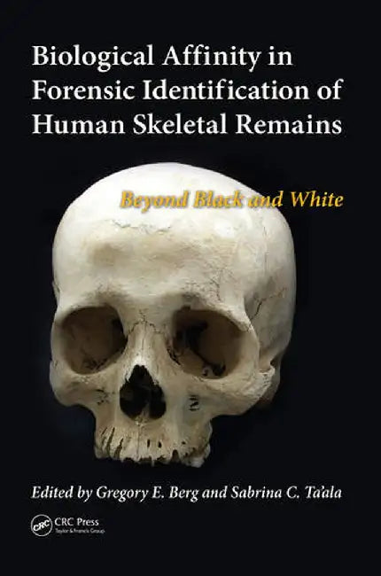 Biological Affinity in Forensic Identification of Human Skeletal Remains: Beyond Black and White by Gregory E. Berg