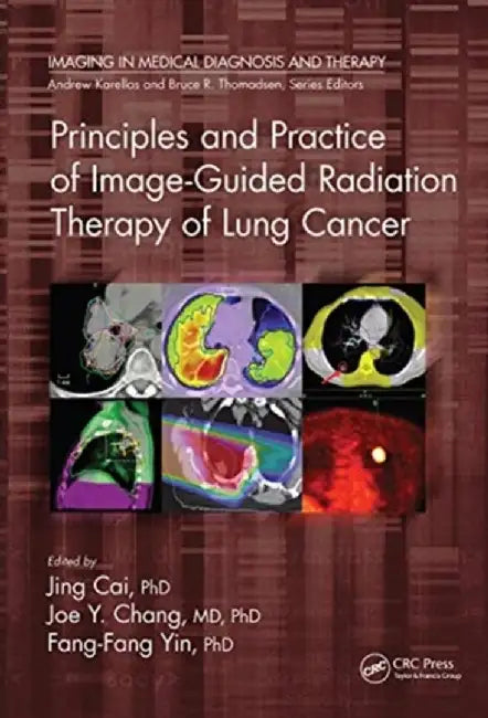 Principles and Practice of Image-Guided Radiation Therapy of Lung Cancer by Jing Cai