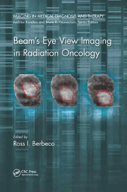 Beam's Eye View Imaging in Radiation Oncology by Ross I. Berbeco Ph.D.