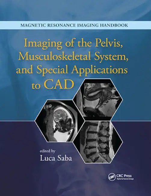 Imaging of the Pelvis, Musculoskeletal System, and Special Applications to CAD by Luca Saba