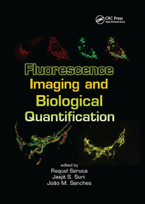 Fluorescence Imaging and Biological Quantification by Raquel Seruca