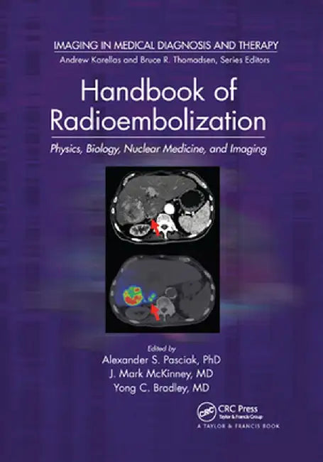 Handbook of Radioembolization: Physics, Biology, Nuclear Medicine, and Imaging by PhD. Pasciak