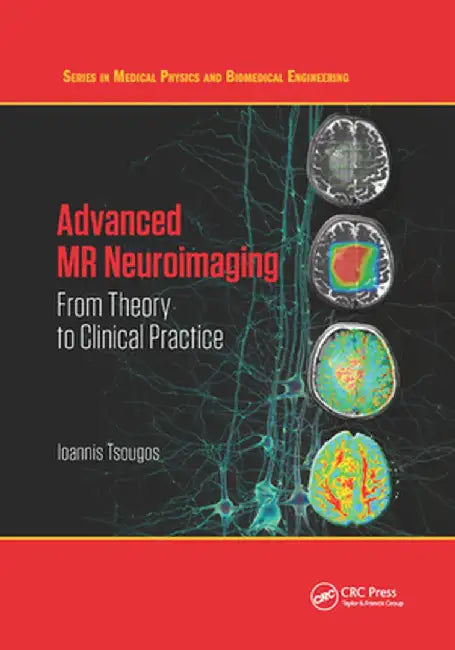 Advanced MR Neuroimaging: From Theory to Clinical Practice by Ioannis Tsougos