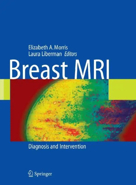 Breast MRI: Diagnosis and Intervention by Laura Liberman