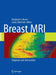Breast MRI: Diagnosis and Intervention by Laura Liberman