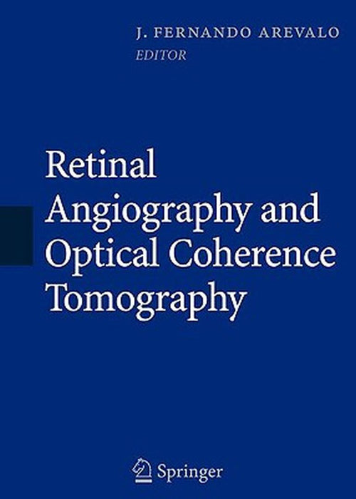 Retinal Angiography and Optical Coherence Tomography by J. Fernando Arévalo