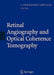 Retinal Angiography and Optical Coherence Tomography by J. Fernando Arévalo
