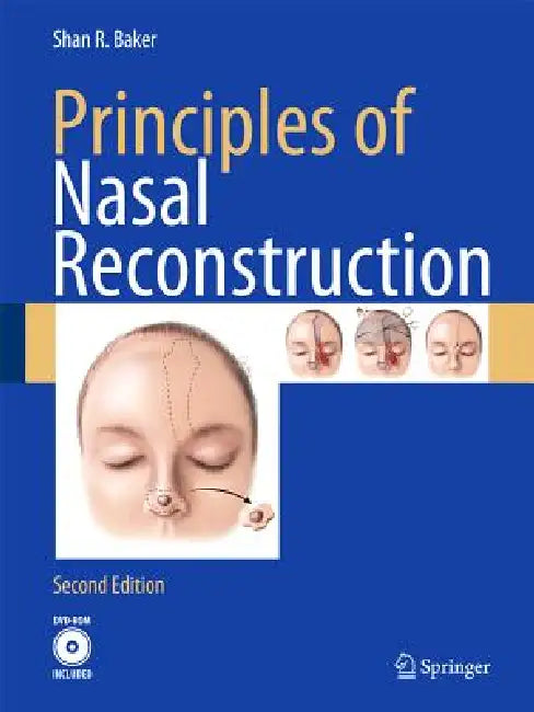 Principles of Nasal Reconstruction by Shan R. Baker
