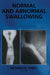 Normal and Abnormal Swallowing: Imaging in Diagnosis and Therapy by Bronwyn Jones