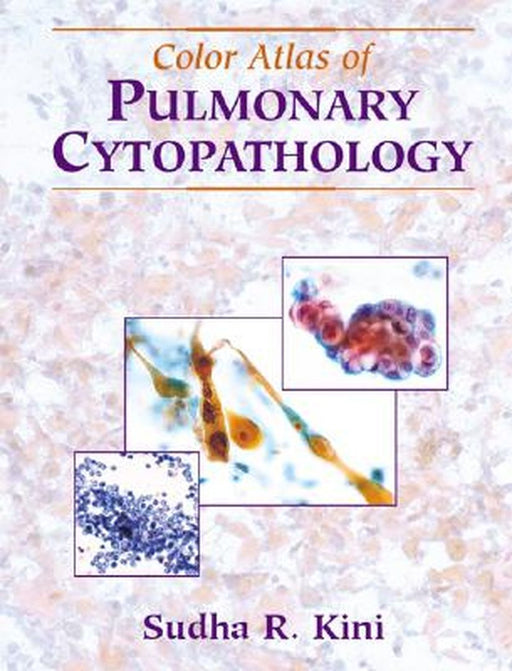 Color Atlas of Pulmonary Cytopathology by Sudha R. Kini