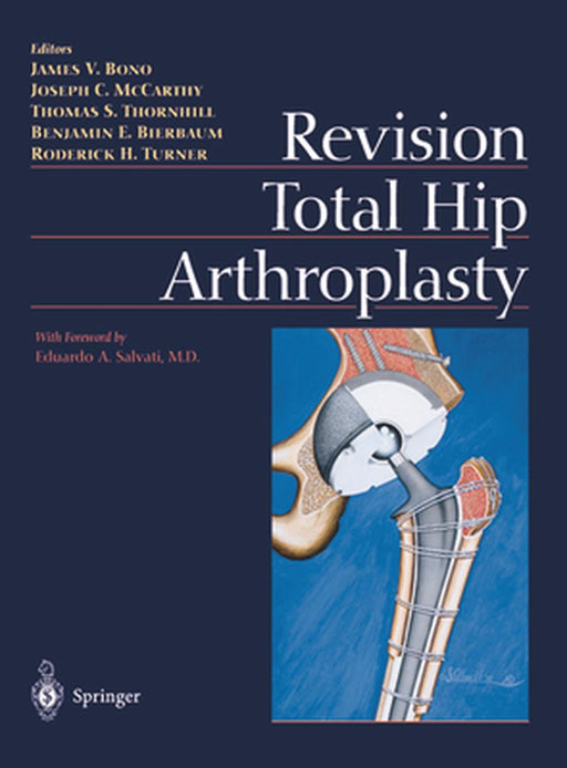 Revision Total Hip Arthroplasty by James V. Bono