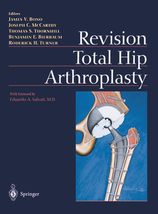 Revision Total Hip Arthroplasty by James V. Bono