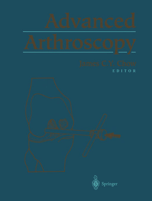 Advanced Arthroscopy by James C. y. Chow