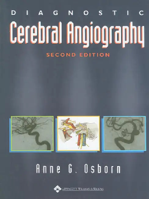 Diagnostic Cerebral Angiography by Anne G. Osborn