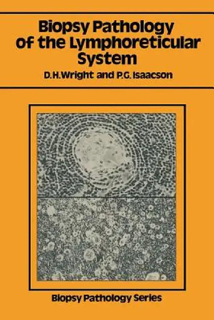 Biopsy Pathology of the Lymphoreticular System by Dennis H. Wright
