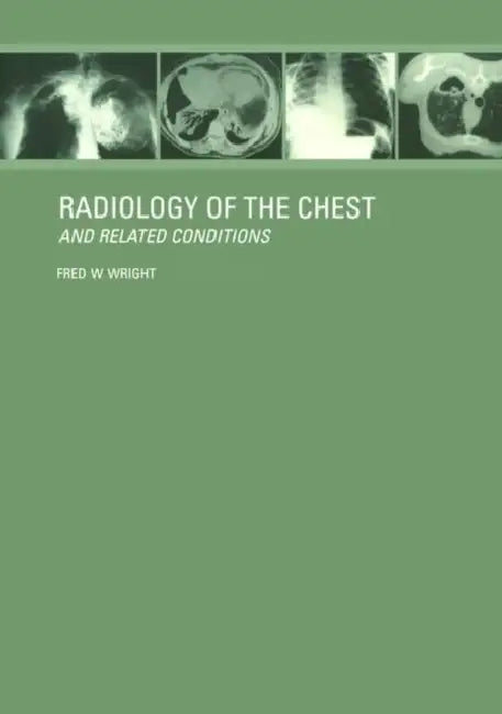 Radiology Of The Chest And Related Conditions With Cd-Rom by Wright