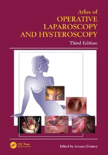 Atlas of Operative Laparoscopy and Hysteroscopy by Jacques Donnez