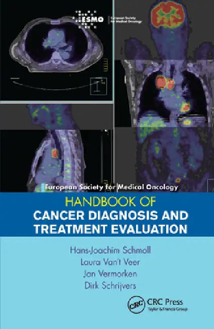 European Society for Medical Oncology Handbook of Cancer Diagnosis and Treatment Evaluation by Hans-Joachim Schmoll
