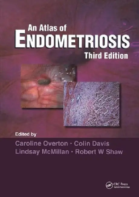 Atlas of Endometriosis by Caroline Overton