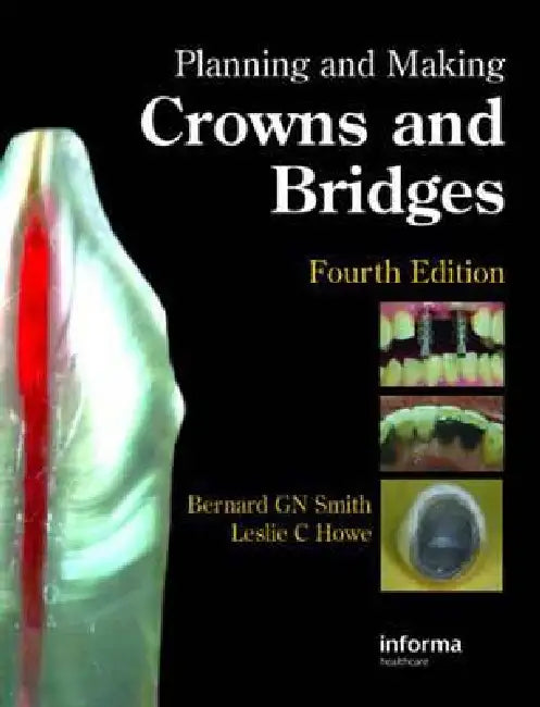 Planning and Making Crowns and Bridges by Bernard G. N. Smith