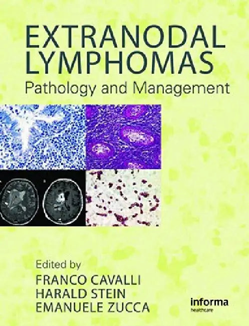 Extranodal Lymphomas: Pathology and Management by Franco Cavalli