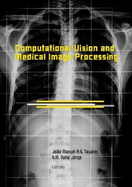 Computational Vision and Medical Image Processing: Vipimage 2007 by João Manuel R. S. Tavares