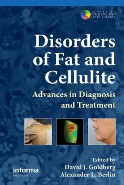 Disorders of Fat and Cellulite: Advances in Diagnosis and Treatment by David J. Goldberg