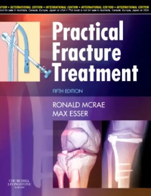 Practical Fracture Treatment, 5e by Mcrae R