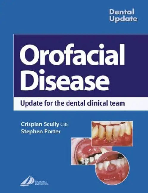 Orofacial Disease: Update for the Dental Clinical Team by Scully